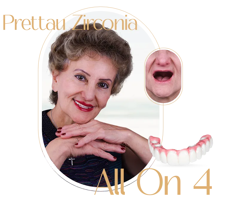 Zirconia All On 4 Mexico, demonstrating high-quality dental restoration work.