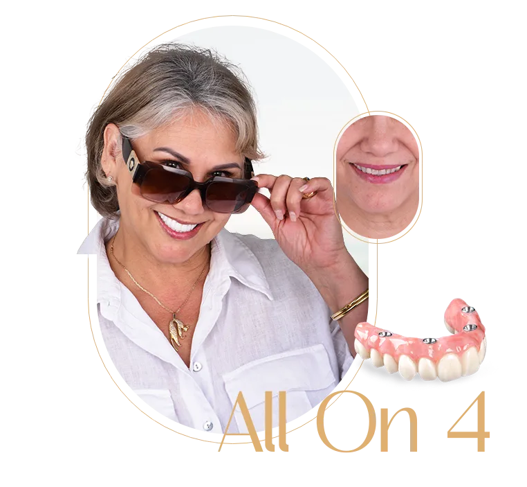 all on 4 results, demonstrating high-quality dental restoration work.