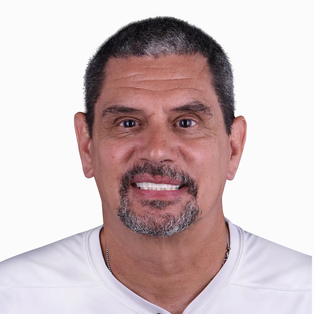 zirconia denture all on 4 results in puerto vallarta