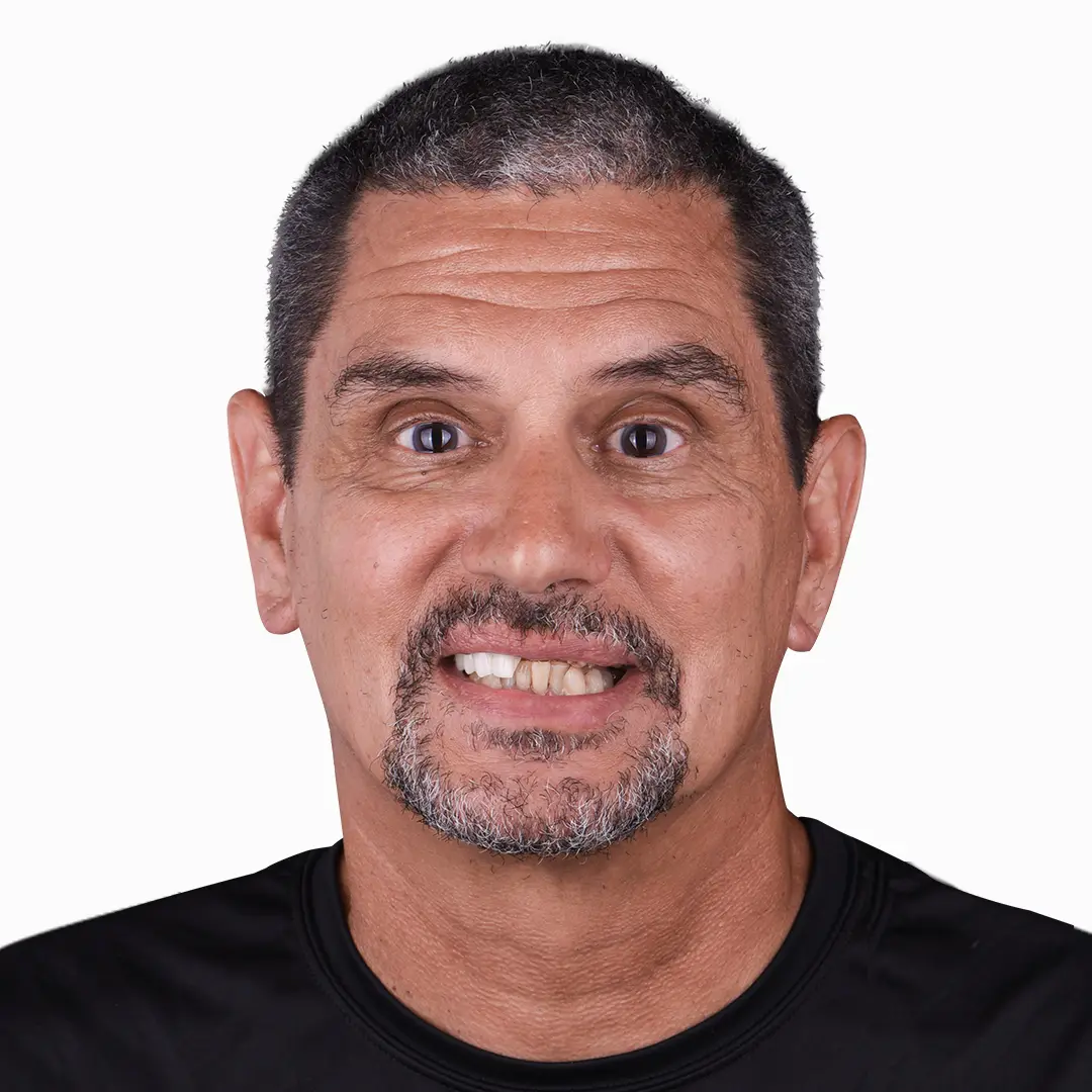 zirconia denture all on 4 results in puerto vallarta