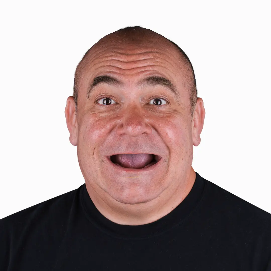 before snap on denture, 4 mini implants treatment