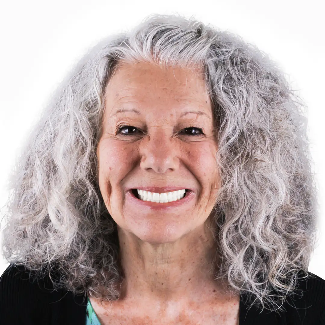 before and after snap on denture, 6 regular implants treatment