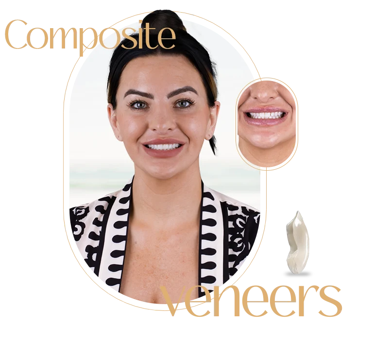 Composite Veneers Cost in Mexico showcasing a patient's enhanced and radiant smile.