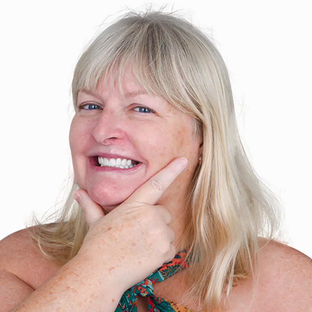 Significant smile improvement shown in before and after images of porcelain veneers