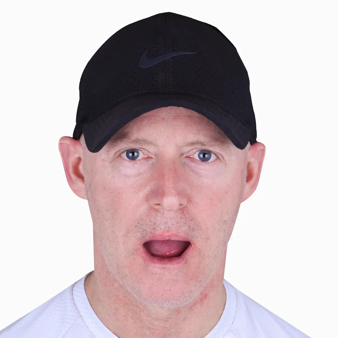 before and after snap on in vallarta