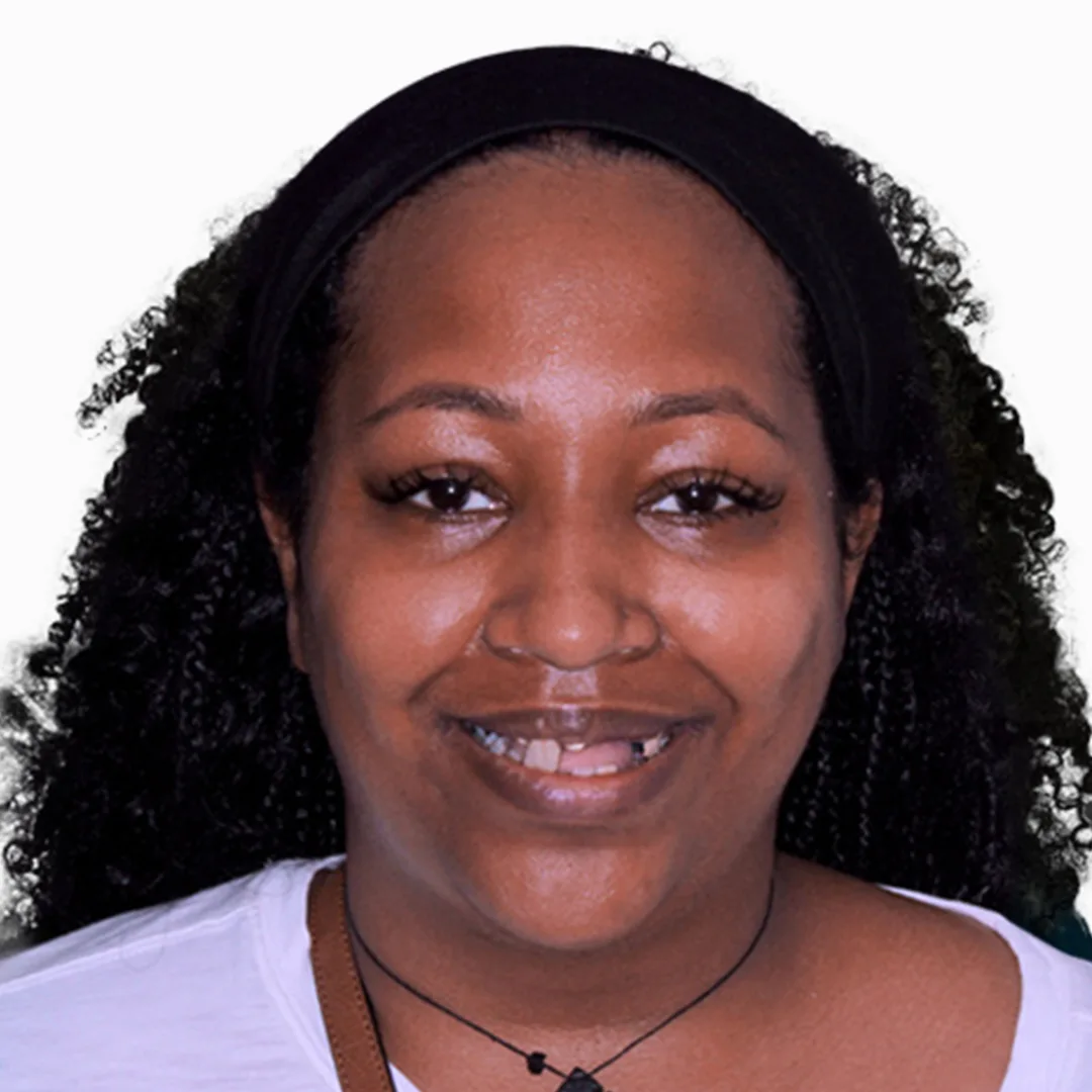 before and after snap on in vallarta dentistry