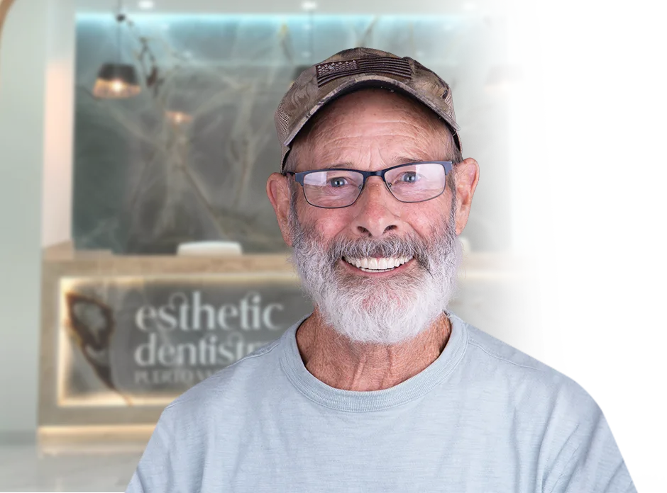 Another example of veneers in Mexico, demonstrating the high standard of dental care available.