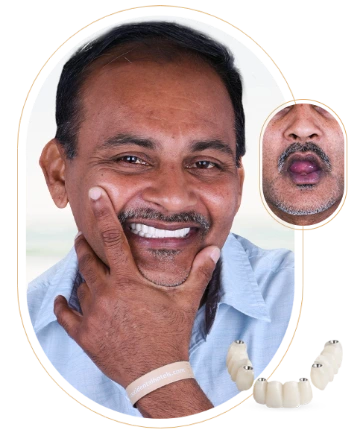 Images showcasing different aspects of veneers treatment