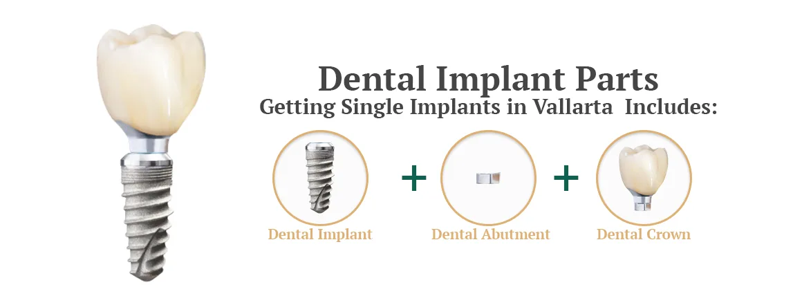 price of crown in puerto vallarta