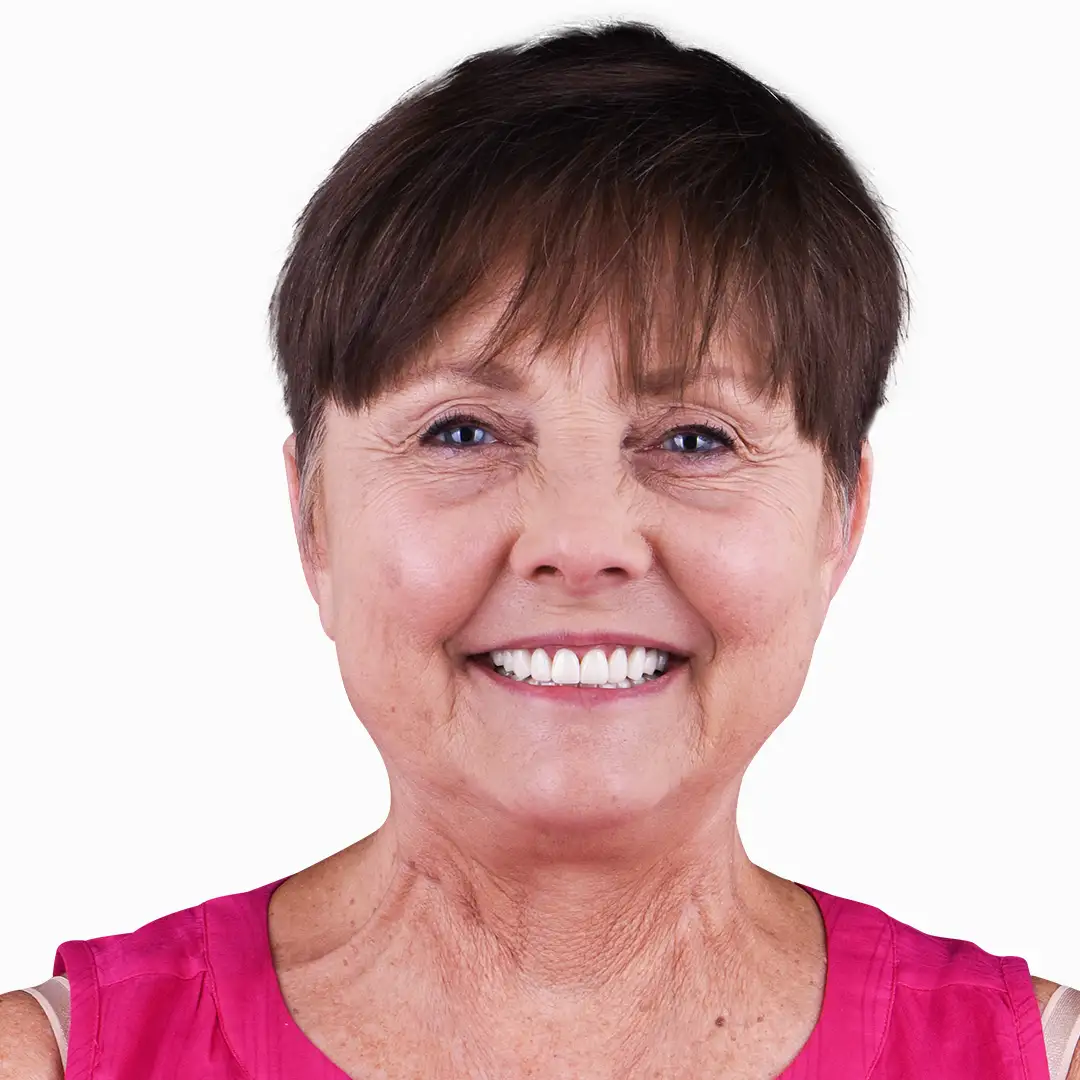 Close-up of before and after images of a dental implant procedure in Puerto Vallarta, highlighting restored teeth.