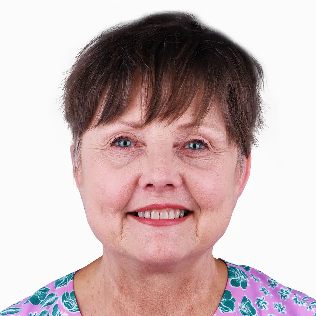 Before and after photos of dental implants in Puerto Vallarta, illustrating the enhancement of dental function and appearance.