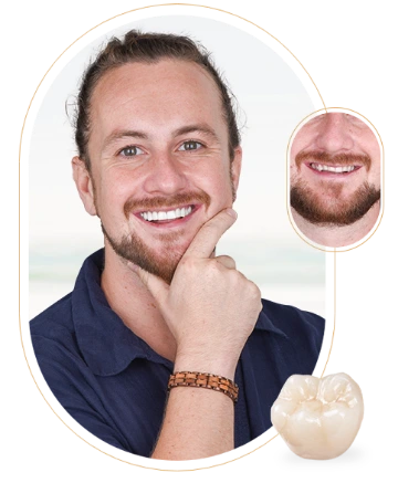 cost of E-max porcelain crowns in Puerto Vallarta.