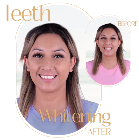 Information on the cost savings of getting teeth whitening treatments in Mexico compared to other countries