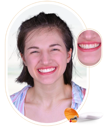 Details about the cost of laser teeth whitening services in Puerto Vallarta, Mexico