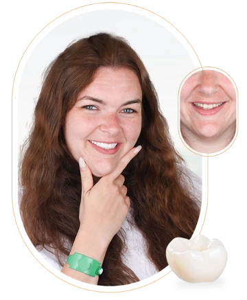 A before-and-after image of a patient with dental crowns in Mexico.