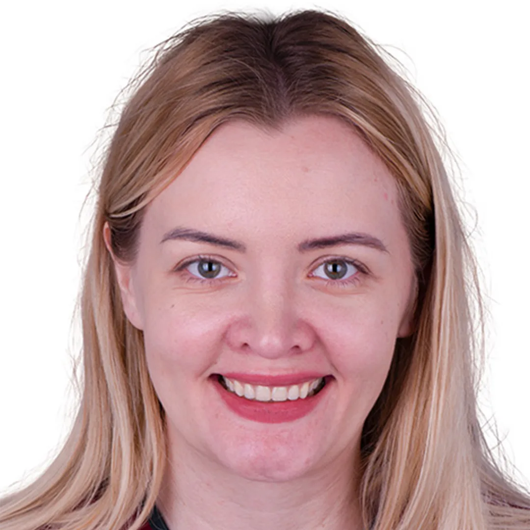 Before and after comparison showing the successful outcome of dental implant treatment in Puerto Vallarta.