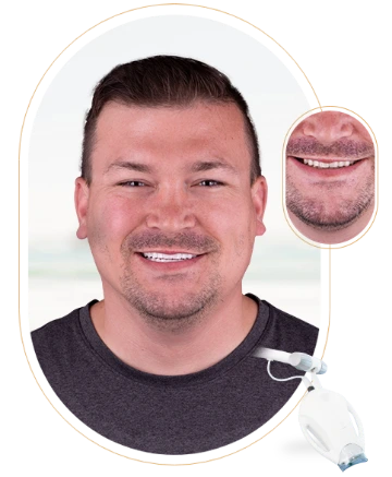 Information on the cost of Zoom teeth whitening services and their benefits