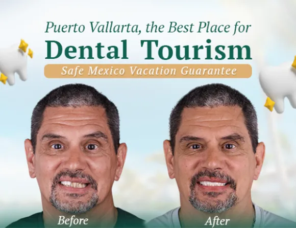 Puerto Vallarta Dental Tourism