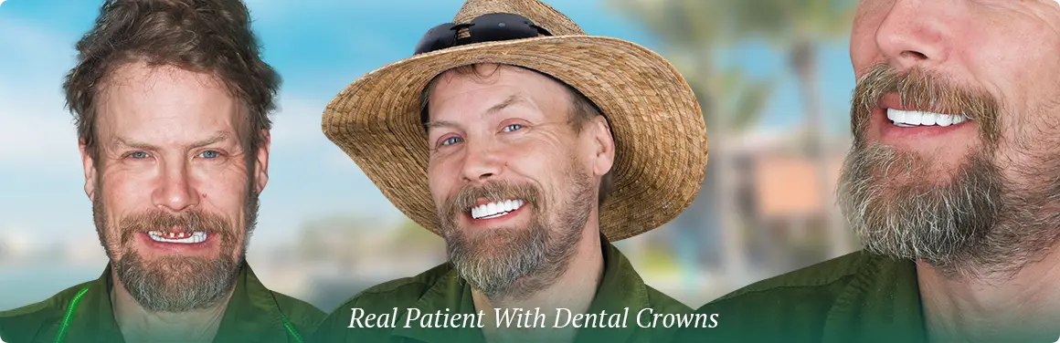 Why Puerto Vallarta is the perfect choice for dental tourism, offering expert services in a tropical paradise.