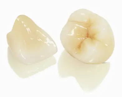 Root canal and crown treatment cost breakdown at a top dental clinic in Puerto Vallarta.