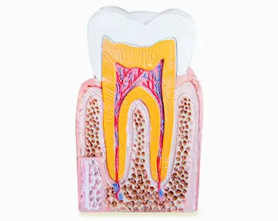 Detailed pricing for root canal and crown procedures in Puerto Vallarta, Mexico, offering affordable options.