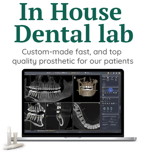 State-of-the-art dental technology and expert care at Puerto Vallarta Dentistry, ensuring advanced and precise treatment results