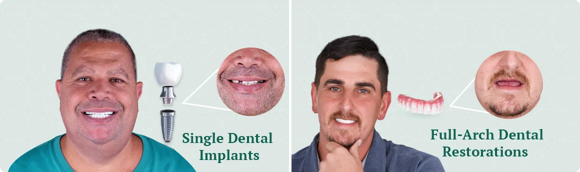 Learn about the cost of dental implants in Puerto Vallarta, offering affordable and high-quality dental care for patients seeking a new smile.