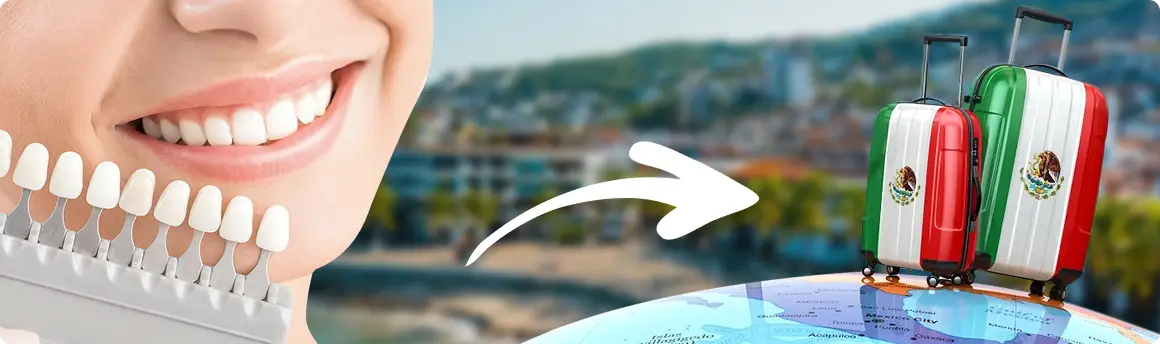 Affordable dental treatment in Mexico offering high-quality care for international patients.