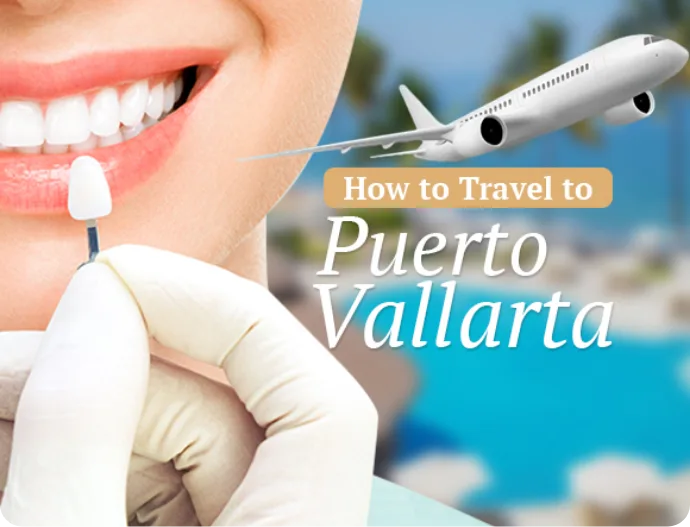 A step-by-step guide to traveling to Puerto Vallarta for top-notch dental care and a stress-free experience.