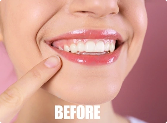 Image illustrating the benefits of planning preventative gum surgery.