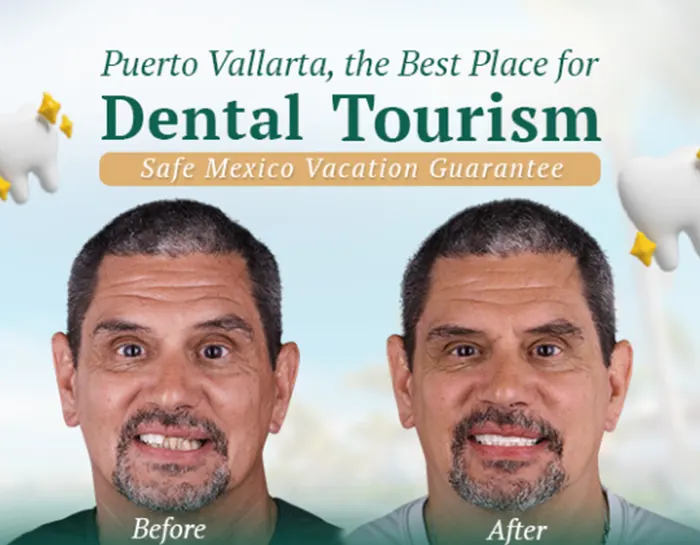 Puerto Vallarta as a leading destination for dental tourism, combining quality care with beautiful surroundings