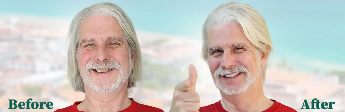 Smiling tourist showing off new teeth after cosmetic dentistry on vacation in Mexico