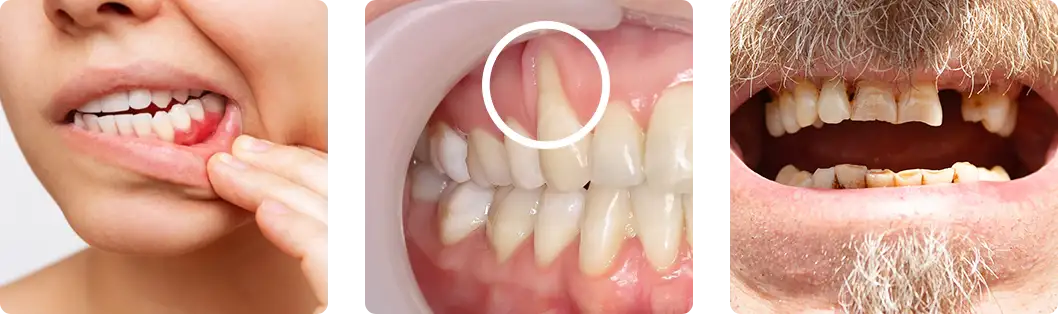 Person with a concerned expression, indicating the need for gum surgery.