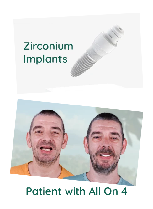 Set of metal-free zirconia dental implants on a sterile tray ready for placement